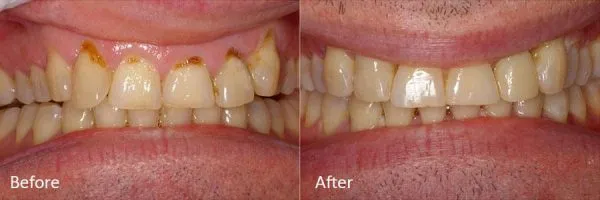 Before & After Gallery Image