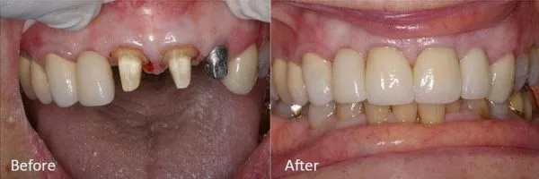 Before & After Gallery Image