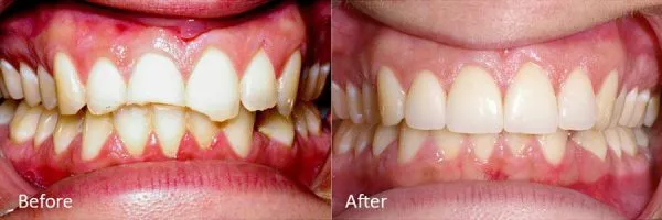 Before & After Gallery Image